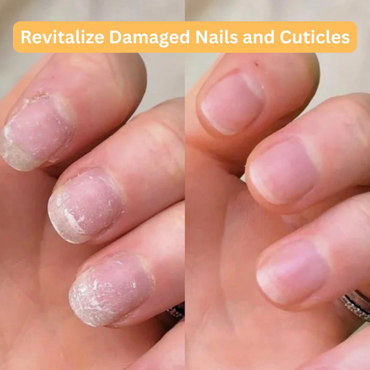 Luxera Nail Growth Oil