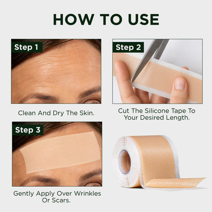 Luxera Medical-Grade Silicone Scar Sheets